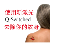 使用新激光Q-Switched去除你的纹身 | DUAL 诊所
