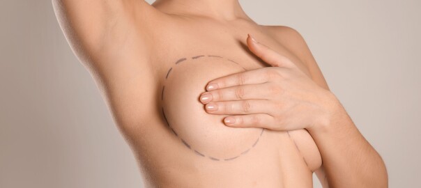 mamoplastia, aumento de pecho